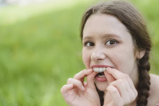 invisalign clear aligner on teeth